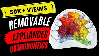 Removable appliances orthodontics Introduction [upl. by Adnohsar]