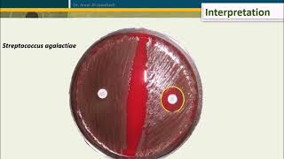 Bacitracin test for Streptococcus pyogenes [upl. by Stroup486]