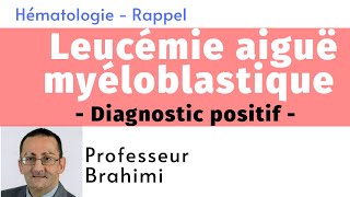 Leucémie Aiguë Myéloblastique Diagnostic positif [upl. by Enttirb]