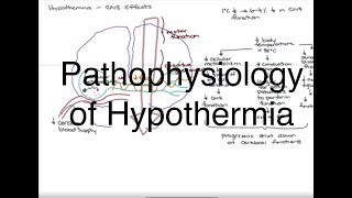 Hypothermia Pathophysiology [upl. by Ardnic]