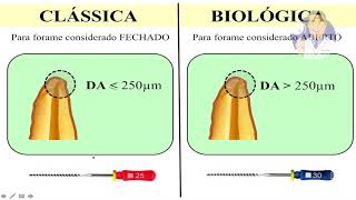 Módulo II  Aula 4 Técnica Obturação [upl. by Peddada]