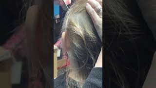 What Does Head Lice Look Like [upl. by Candless]