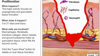 Stages of Wound Healing Process [upl. by Anastassia]