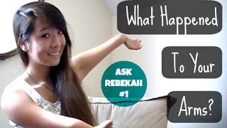 Ask Rebekah 1 What Happened To Your Arms [upl. by Sukramal]