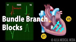 Bundle Branch Block Animation [upl. by Cram]