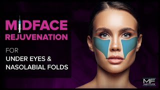 Under Eye and Midface Rejuvenation with Dermal Fillers at Mabrie Facial Institute [upl. by Oballa]