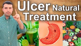 Do This And Cure Your Stomach Pain Gastritis and Ulcers  Best Natural Treatment of Stomach Pain [upl. by Birkner]