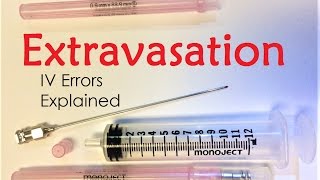 Extravasation  IV Infiltration Errors Explained Doctor Interview [upl. by Adniram]