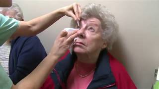 Watch An Eylea Eye Injection [upl. by Karena125]