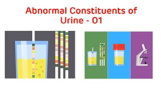 Analysis of Abnormal Urine  Abnormal Urine Constituents Practical Part I  Biochemistry Practical [upl. by Henke211]