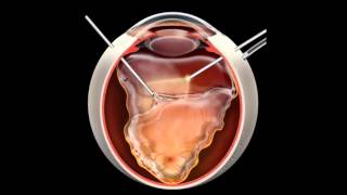 Retina  Few Important Points  Part 3 [upl. by Neelhtac465]