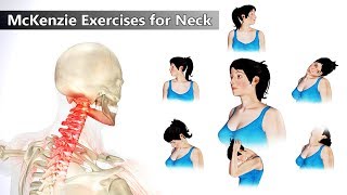 Fix Forward Head Posture  3 Easy Exercises From a Chiropractor [upl. by Blanc]