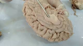 Basal Ganglia of Brain  Neuroanatomy [upl. by Anairt769]