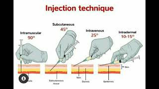 Injection Techniques quotIntermuscular Subcutaneous Intravenous Intradermalquot [upl. by Adnuhsat]