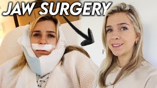 My Jaw Surgery Experience  Before amp After 3 Months Post Op [upl. by Reace]