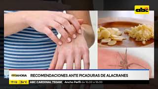 Recomendaciones para prevenir y tratar picaduras de alacranes [upl. by Skeie533]