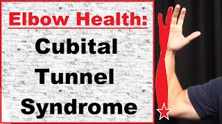 Elbow Cubital Tunnel Syndrome [upl. by Attenreb174]