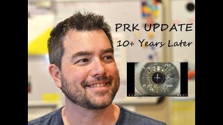 10 Years after PRK Laser Eye Surgery [upl. by Reg25]