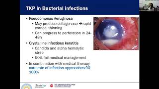 Cornea 2 Corneal Surgery [upl. by Atirehgram]