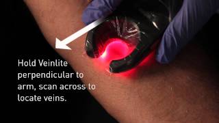 Veinlite LED Vein Finder Demo [upl. by Ioab]