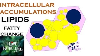 INTRACELLULAR ACCUMULATIONS LIPIDS Fatty Change [upl. by Leonardi]