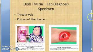 Microbiology 213 b Diptheria Lab Diagnosis [upl. by Inhsor733]