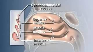 Anatomy of the Nasal Cavity [upl. by Yousuf4]