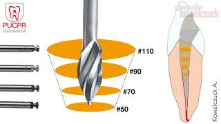 Técnica de Preparo Manual do Canal Radicular  Endodontia PUCPR [upl. by Yoko]