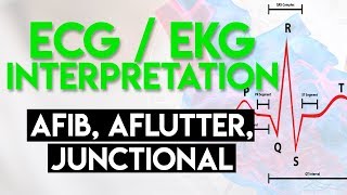 Sinus Arrhythmia ECG  EMTprepcom [upl. by Denten457]