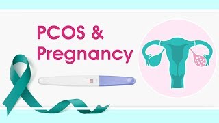 PCOS and Pregnancy [upl. by Radke642]