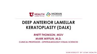 ZEPTO®️ Procedure Animation [upl. by Boot]