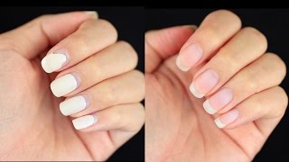 How to Remove Gel Nails at Home DamageFree [upl. by Hite]