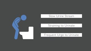 10 Causes of Loose Stools How to treat and home care  Dr Rajasekhar M R  Doctors Circle [upl. by Natalia]