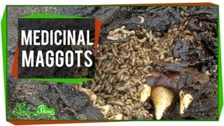 Marvelous Medicinal Maggots [upl. by Lampert]