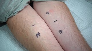 Interpreting Allergy Test Results [upl. by Faust]