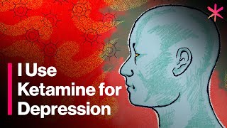 I Use Ketamine for Depression  Here’s How It Works [upl. by Queridas58]