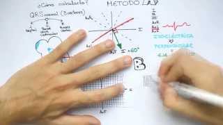 DRAW EKG 1 Eje Cardiaco ¿Cómo calcularlo [upl. by Scholem554]