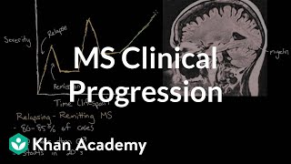 Clinical progression of multiple sclerosis  Nervous system diseases  NCLEXRN  Khan Academy [upl. by Cumine]