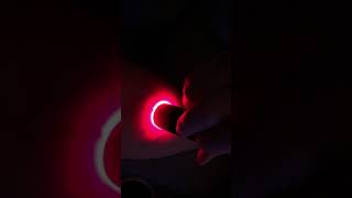 Illumivein Vein Finder In Use  Demonstration Video [upl. by Una]