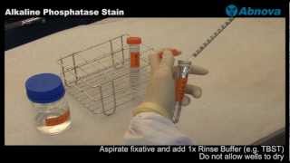 Alkaline Phosphatase Stain [upl. by Atled]