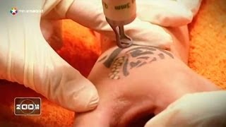 Cómo borrar tatuajes con láser [upl. by Hadlee]