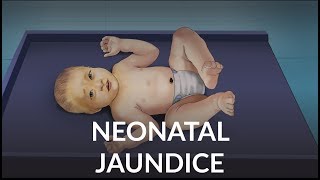 Neonatal Jaundice by L Veit  OPENPediatrics [upl. by Ailemaj]