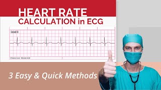 HOW TO READ AN ECG WITH ANIMATIONSin 10 mins [upl. by Conner]