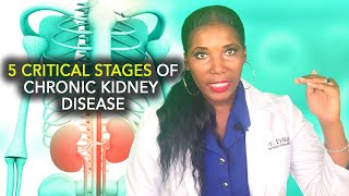 Stages of Chronic Kidney Disease CKD [upl. by Hawker]