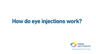 How do eye injections intravitreal injections work [upl. by Adnarahs]