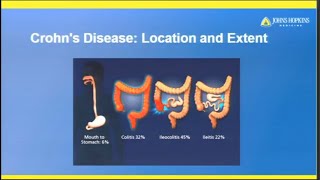 1 INTESTINAL OBSTRUCTION  Bowel Obstruction  Small Bowel Obstruction  Large Bowel Obstruction [upl. by Joliet]