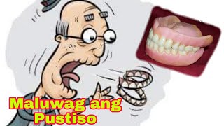 Solution At Remedy Maluwag na Pustiso Loose Dentures Ano ang Dapat Gawin kapag Maluwag ang Pustiso [upl. by Pronty81]