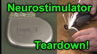 EEVblog 1027  Implantable NeuroStimulator Teardown [upl. by Ellata439]