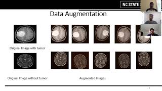 Brain Tumor Detection using Convolutional Neural Network [upl. by Atteras]