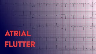 Atrial Flutter  EKG ECG Interpretation [upl. by Idelle]